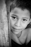 Clinica Verde - Nicaraguan boy given new hope